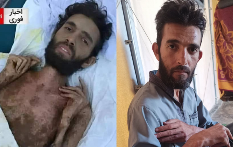 E rreme foto e të shpëtuarit pas 4 muajsh prej tërmetit në Siri