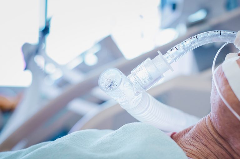 I keqinterpretuar studimi amerikan mbi viktimat e respiratorëve të Covid-19 I keqinterpretuar studimi amerikan mbi viktimat e respiratorëve të Covid-19