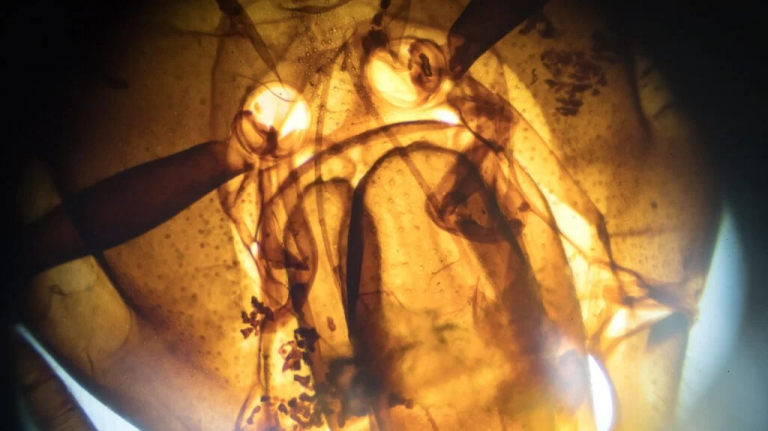 Pickimi nga bletët nuk shëron kancerin pavarësisht disa rezultateve laboratorike