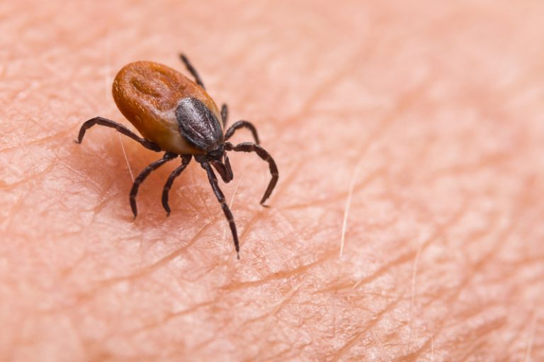 Rriqnat transmetonin sëmundje përpara se të krijoheshin bioarmët në ShBA