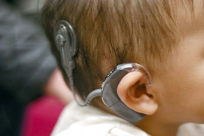 DiversifiedHearing-benefits-cochlear-implants-ny